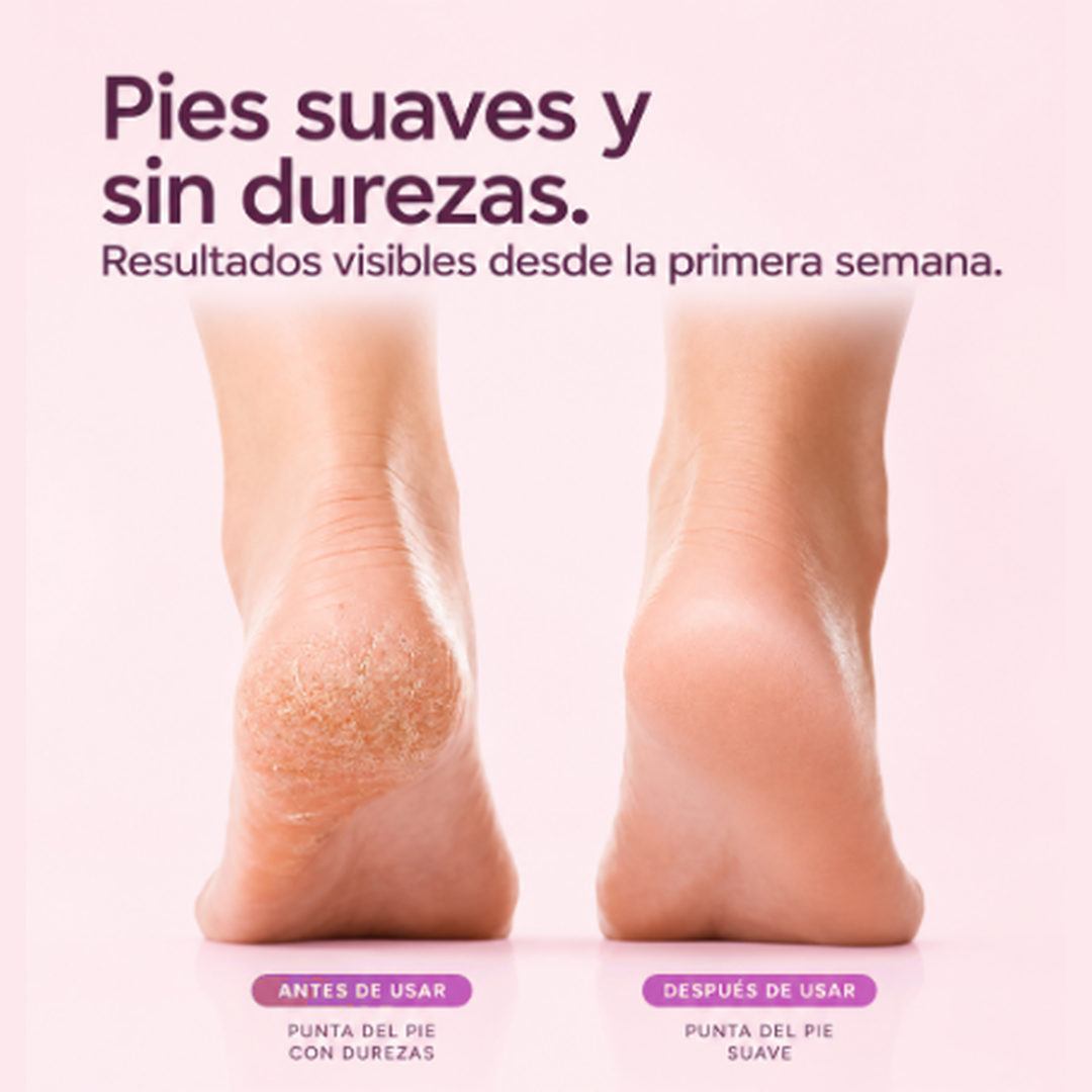 PediPure™ Pies Suaves Sin Durezas y en Casa